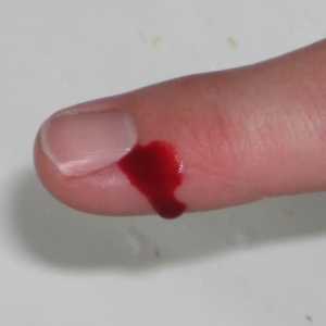 Cum să oprești sângele într-o tăietură: secvența de acțiuni