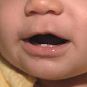 Cum să distingem un dinte de copil de rădăcina unui copil?