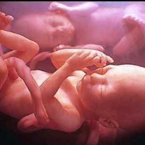 Cum se nasc gemenii? Belly după gemeni de naștere