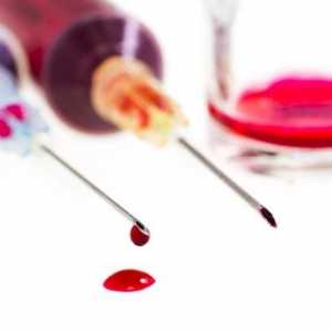 Cum să dăruie corect sânge hormonilor?