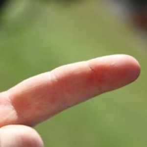 Cum de a scoate o scuipă de pe deget? Sfat bun