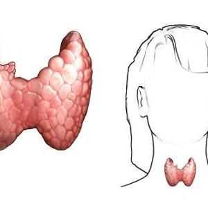 Care sunt semnele de boală tiroidiană la femei?