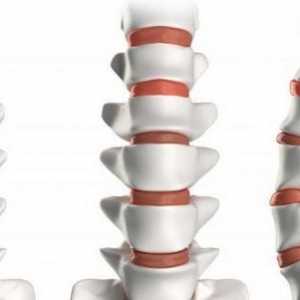 Care este funcția discurilor cartilaginoase dintre vertebre? Structura umană a coloanei vertebrale