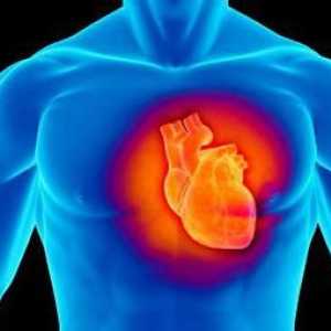 Cardiomiopatia este ... Cardiomiopatia disormală și dismetabolică