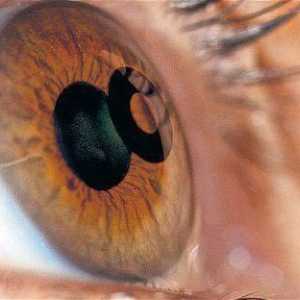 Cataracta chirurgie: recenzii, care lentilă este mai bine? Clinica oftalmologică