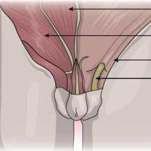 Chistul cordonului spermatic la un băiat: cauze, fotografii, tratament, intervenții chirurgicale,…