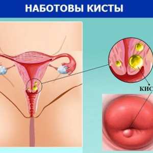 Chistul cervical: simptome și tratament