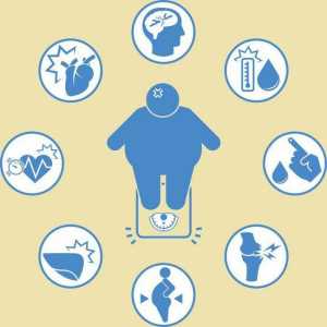 Clasificarea obezității. Cauze, simptome, diagnostic și tratament al obezității