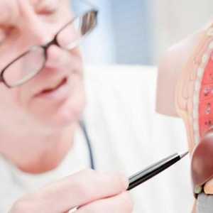Clasificarea severității cirozei hepatice de către Child-Pugh