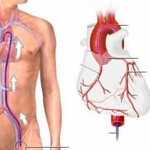 Angiografia coronariană a vaselor inimii: cum o fac, costul, complicațiile. Angiografia coronariană…