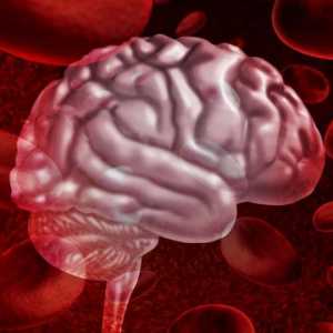 Hemoragie la nivelul creierului: simptome, tratament, consecințe, prognostic