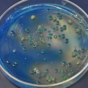 Proprietățile culturale ale bacteriilor: definiția, descrierea, caracteristicile și funcțiile