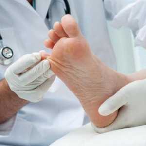 Lac de la ciuperca unghiilor la picioare: recenzii, aplicare, regimuri de tratament
