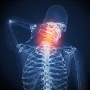 Exerciții de fizioterapie pentru osteochondroza coloanei vertebrale cervicale: fotografii, exerciții