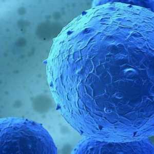 Tratamentul cu celule stem: caracteristici și eficacitate