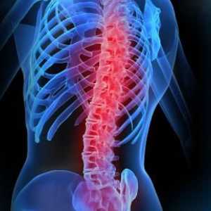 LFK pentru coloanei vertebrale: exerciții și proceduri