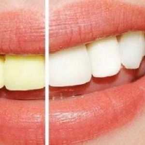 Cele mai bune geluri de albire a dinților: recenzii ale producătorilor, recomandări pentru utilizare