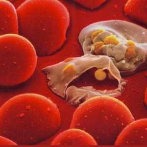Plasmodiul malaric este de tip Sporoviks. De ce este periculoasa o singură celulă?