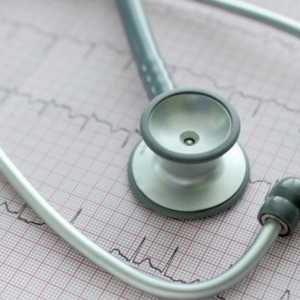 Fibrilația atrială a inimii: ce este și cât de periculoasă este aceasta?