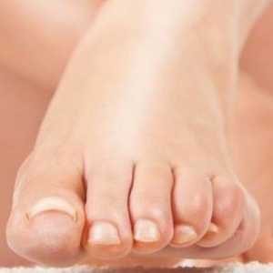 Micoză a unghiilor de pe picioare: tratament cu medicamente și remedii folclorice