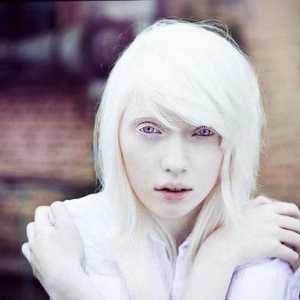 Nastya Zhidkova: model albinic cu aspect non-standard