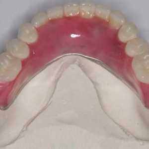 Proteză din nailă cu absența completă a dinților și parțială. Recenzii despre protezele nylon