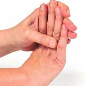 Mâna Nemet: cauze și tratament adecvat