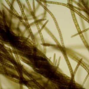 Algele filamentoase: etapele de dezvoltare, reproducere, cum să scoateți din acvariu?