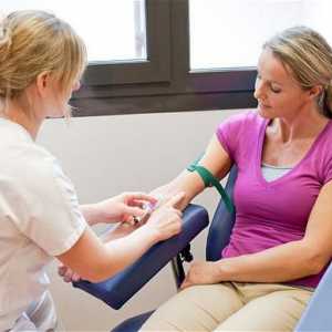 Norma testului de sânge al unei femei. Analiza generală sau comună a unui sânge: normă sau rată la…