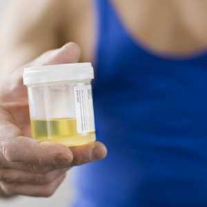 Care este culoarea urinei? Ce culoare ar trebui să fie urina unei persoane sănătoase?