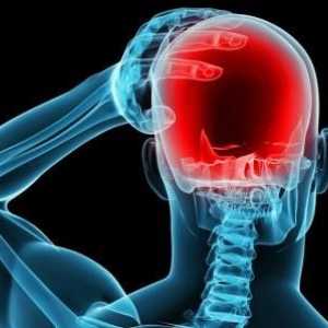 Cu privire la modul de tratare a unei migrene