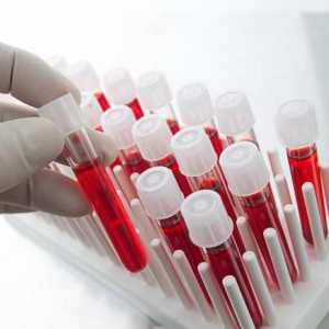 Identificarea leucocitelor în analiza sângelui. copie