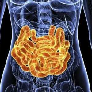 Obstrucția obstructivă intestinală: cauze, simptome, diagnostice și metode de tratament