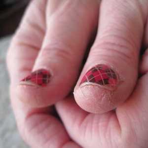 Pielea foarte uscata a mainilor: ce sa fac? Remedii cosmetice și folk pentru îngrijirea pielii