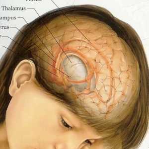 Brain tumorii: simptome într-un stadiu incipient. Primele semne ale unei tumori cerebrale