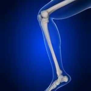 Umflarea genunchilor: cauze