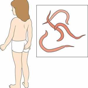 Pinworms la un copil: metode de tratament și prevenire a bolilor
