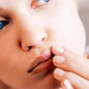 Din ceea ce apare herpesul pe buze: cauzele, prevenirea, trăsăturile de tratament