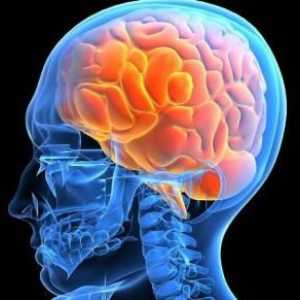 Edemul creierului: cauze și consecințe. Edem cerebral la copii și adulți