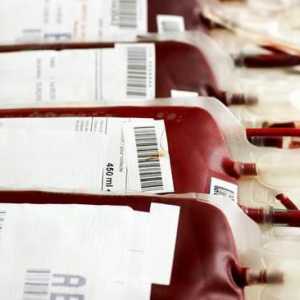 Transfuzia de sânge pe grupe de sânge: reguli. Donatorii universali. Tabel de compatibilitate a…