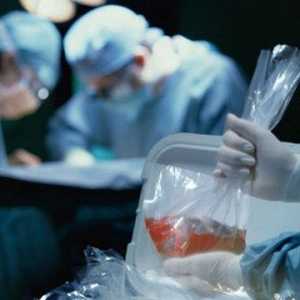 Transplantul de rinichi: o operație în care se face, viața după intervenție, o coadă