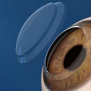Transplantarea corneei ochiului: descriere, indicații, costuri, recenzii. Microchirurgia ochiului