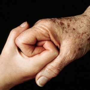 Piesele pigmentate pe mâini: cauze și remedii