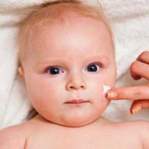 Locurile pigmentate la copii: cauze, tratament. Îndepărtarea petelor pigmentate