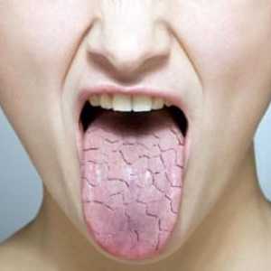 Dimineața, uscăciunea gurii: cauze, tratament și consecințe