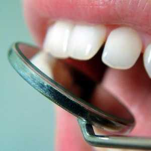 De ce durerea dintilor dupa indepartarea nervului: cauze posibile si moduri de tratament