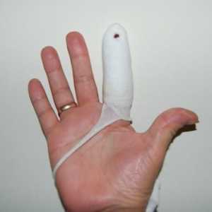 Detalii despre cum să rupă un deget pe braț sau pe picior