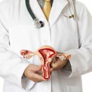 Polipi în uter: cauzele educației. Polipi în uter: simptome și tratament