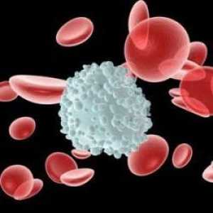 Limfocite crescute ale sângelui: cauzele necesită clarificare