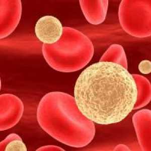 Limfocite crescute ale sângelui la copii: ceea ce trebuie să știți